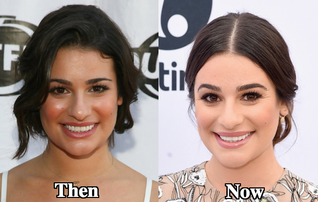 Lea Michele Nose job before and after photos