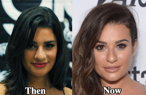 Lea Michele nose alteration before and after