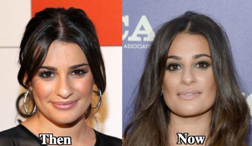Lea Michele Nose Job Plastic Surgery Before and After Photos - Latest