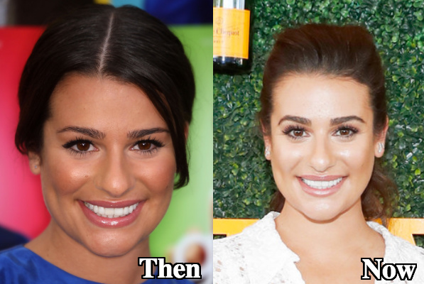 Lea Michele nose job before and after images