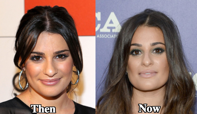 Lea Michele nose job before and after