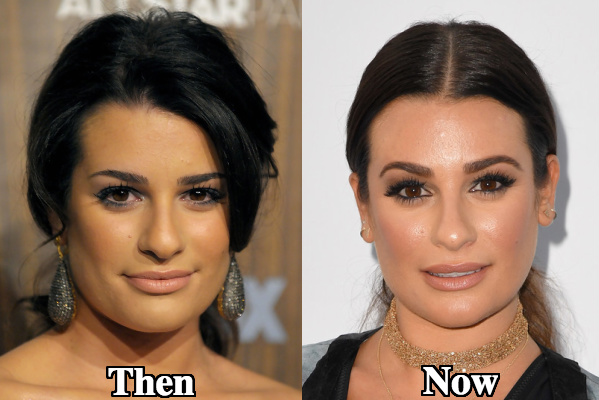 Lea Michele nose job rhinoplasty