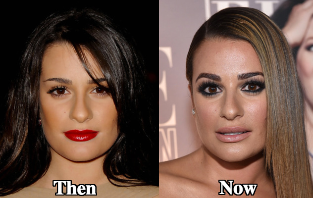 Lea Michele nose job then and now