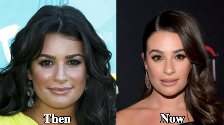 Lea Michele nose shape change before and after photos
