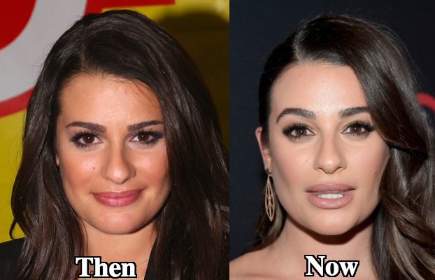 Lea Michele nose size difference photos