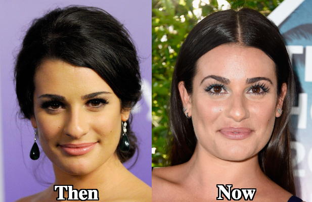 Lea Michele nose surgery