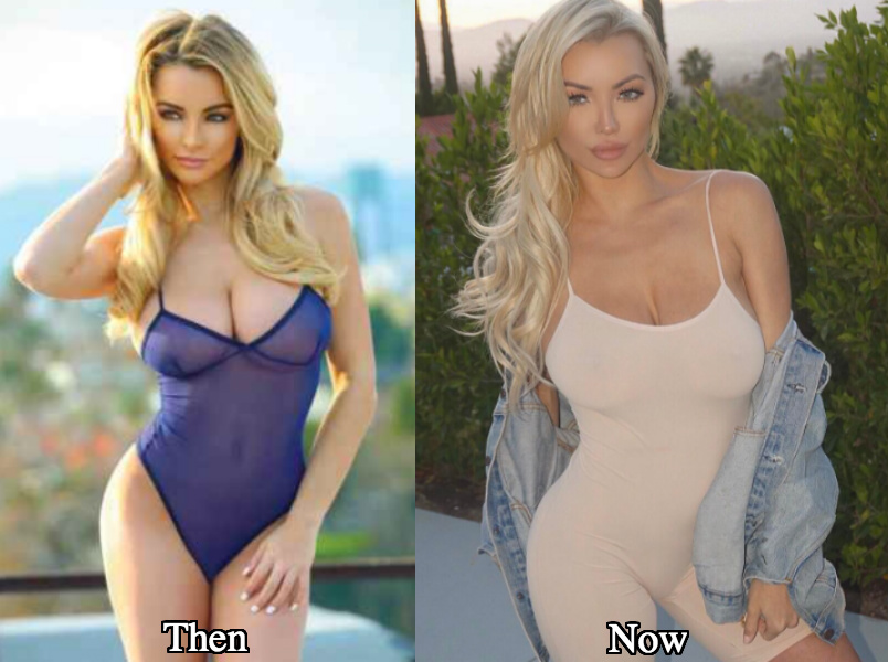 Lindsey Pelas boob job before and after photos