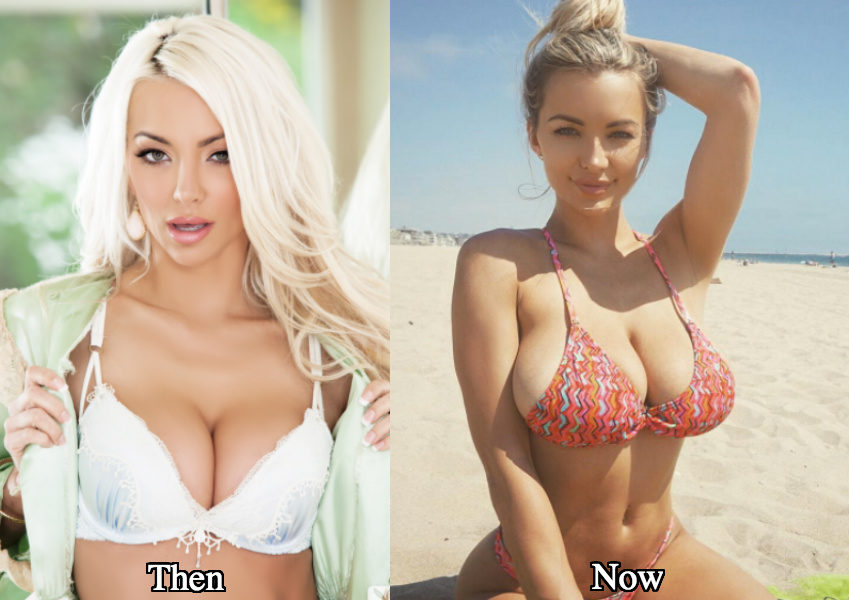 Lindsey Pelas breast augmentation before and after photos