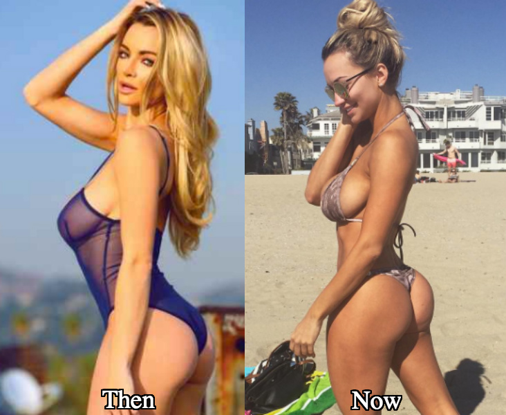 Lindsey Pelas breast implants before and after photos