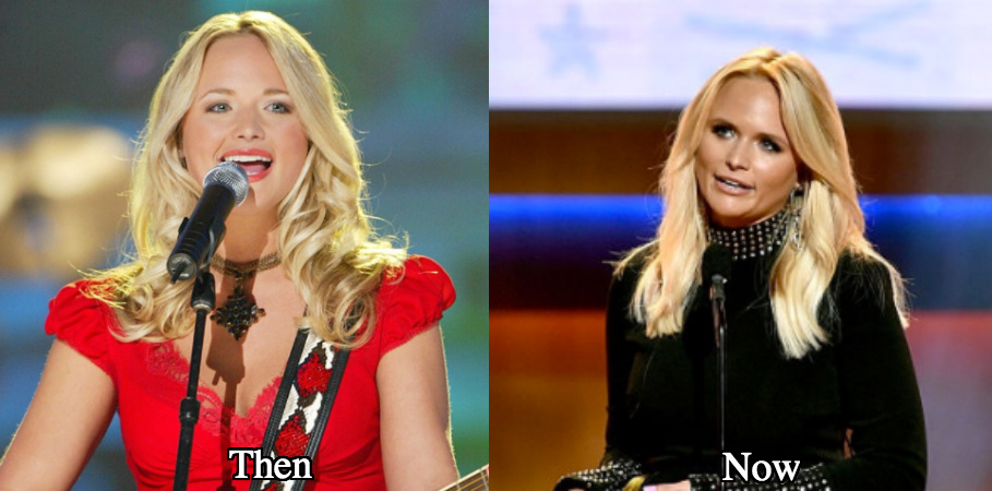 Miranda Lambert before and after