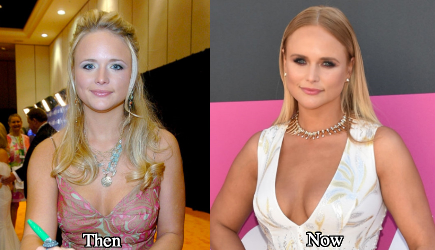 Miranda Lambert breast augmentation before and after photos