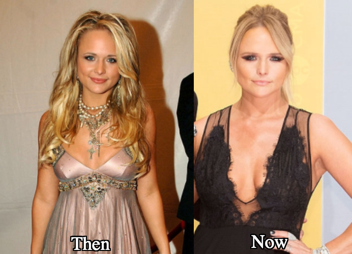 Miranda Lambert breast implants surgery before and after