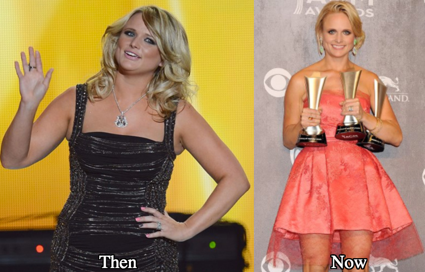 Miranda Lambert liposuction before and after