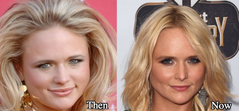 Miranda Lambert Plastic Surgery and Weight Loss Before and After Photos