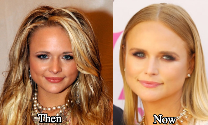 Miranda Lambert plastic surgery before and after photos