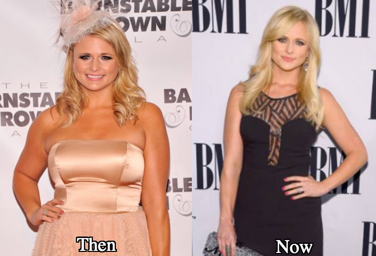 Miranda Lambert weight loss liposuction before and after photos