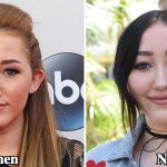 Noah Cyrus Plastic Surgery Before and After Photos