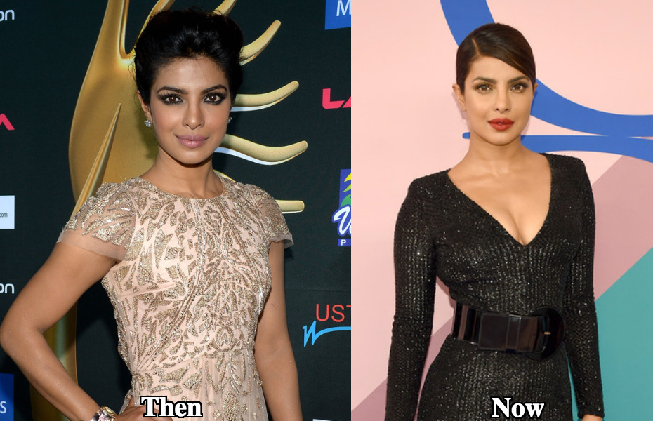 Priyanka Chopra boob job before and after