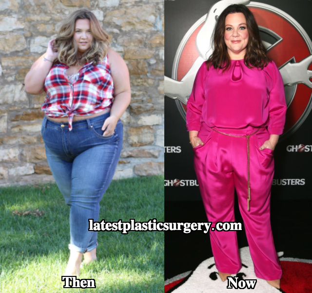 Melissa McCarthy Weight Loss Before and After Photos