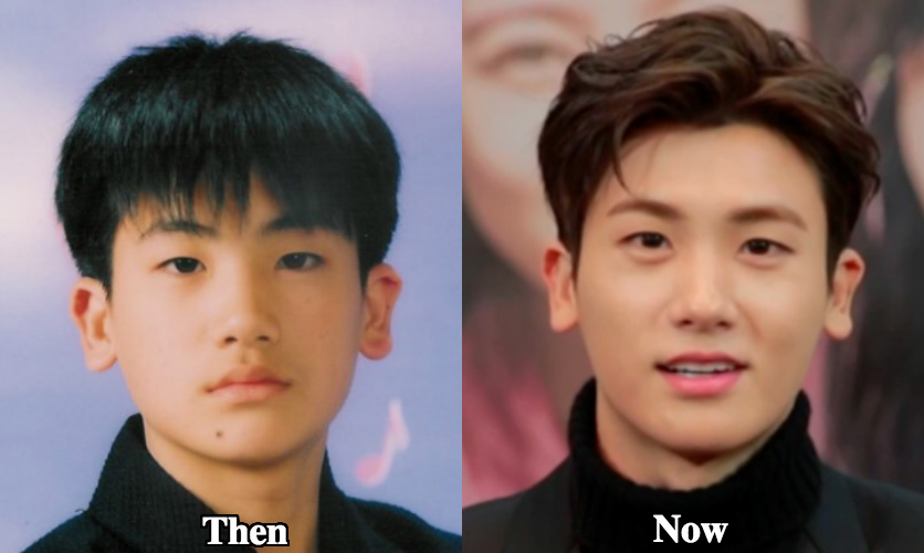 Park Hyung Sik Plastic surgery before and after photos