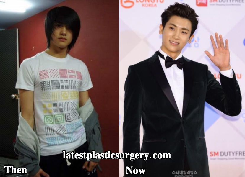 Park Hyung Sik before and after