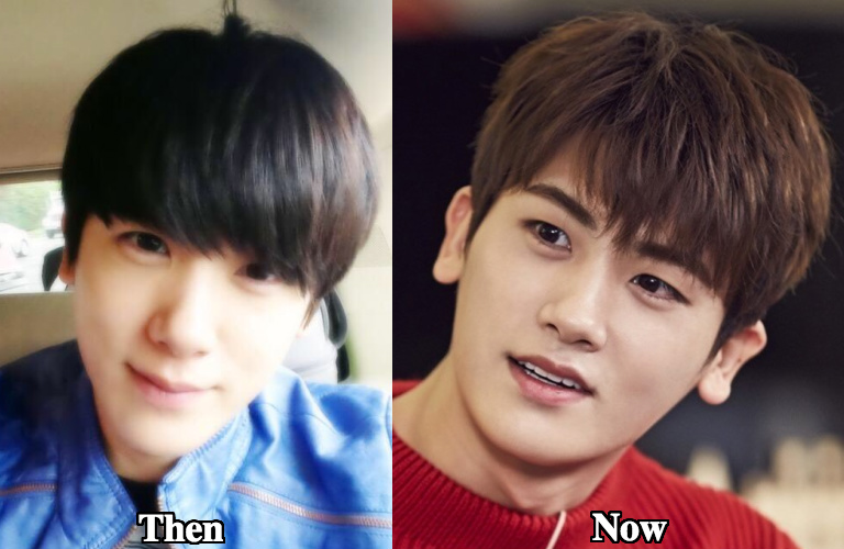 Park Hyung Sik nose job before and after photos