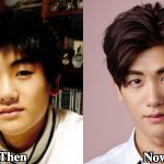 Park Hyung Sik Plastic Surgery Before and After Photos