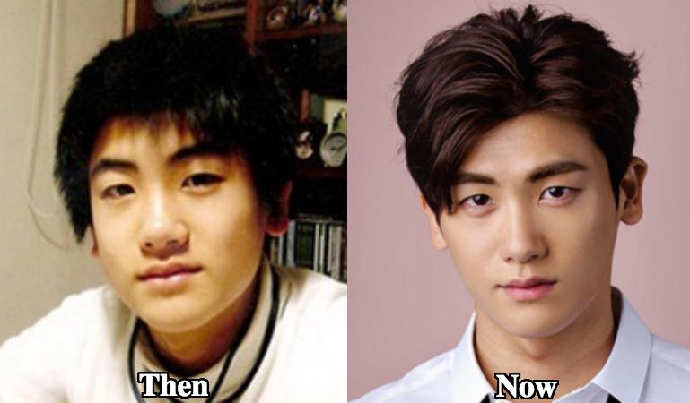 Park Hyung Sik plastic surgery before and after pictures