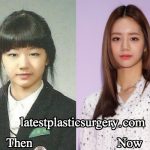 Hyeri Plastic Surgery Before and After Photos – True or False?