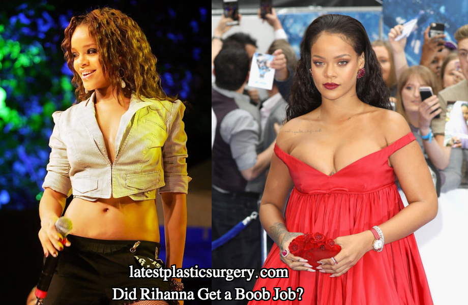 Rihanna boob job before and after photos