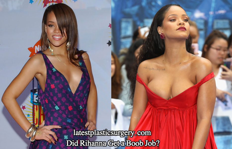 Rihanna breast augmentation boob job