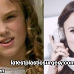 Keira Knightley Teeth Alignment – Did She Undergo teeth plastic surgery?