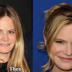 Jennifer Jason Leigh Plastic Surgery Before and After Photos