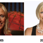 Candice Olson Plastic Surgery Before And After