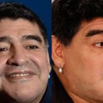 Diego Maradona Plastic Surgery Before And After