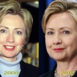 Hillary Clinton Plastic Surgery Before and After