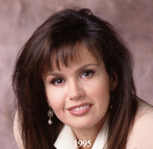 Marie Osmond Plastic Surgery Before and After - Latest Plastic Surgery ...