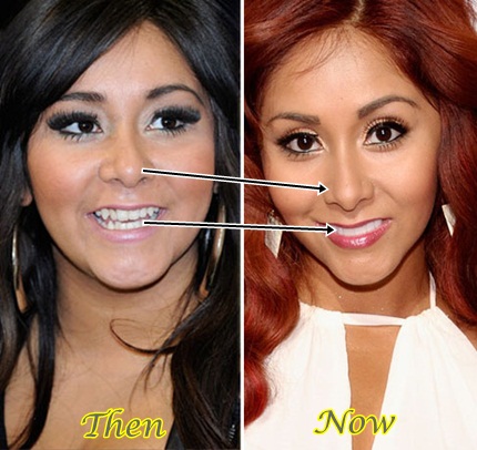 Nicole-Polizzi-Snooki-Plastic-Surgery-Before-After-Photos - Latest