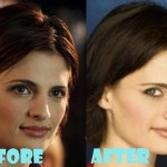 Stana Katic Plastic Surgery Before And After