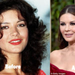Catherine Zeta Jones Plastic Surgery Before and After Photos