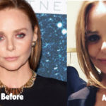 Stella McCartney Plastic Surgery Before And After Photos