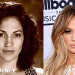 Jennifer Lopez Plastic Surgery Before and After Photos