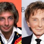 Barry Manilow Plastic Surgery Before and After Photos