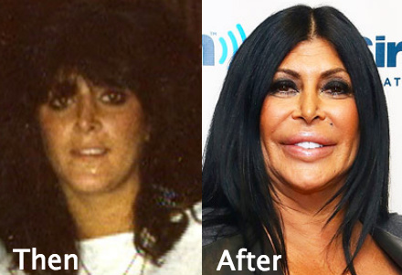 Big Ang Plastic Surgery Gone wrong - Latest Plastic Surgery Gossip And News...