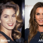 Cindy Crawford Plastic Surgery Before and After Photos – Looking Good At Age 49