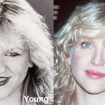 Courtney Love Plastic Surgery Before and After Photos