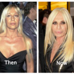 53 Celebrity Plastic Surgery Gone Wrong With Photos