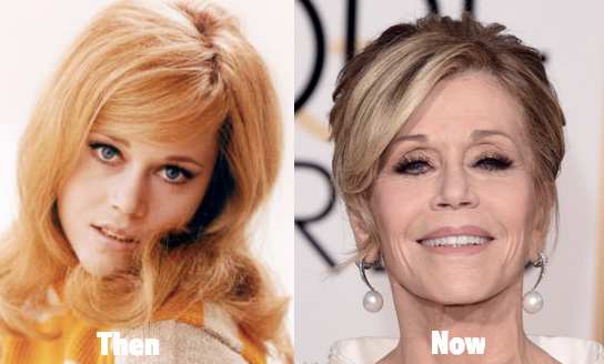 Jane Fonda Plastic Surgery Before And After Photos Ce - vrogue.co