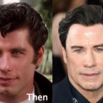 John Travolta Plastic Surgery Before and After Photos