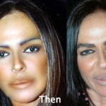 Michaela Romanini Plastic Surgery Before and After Photos